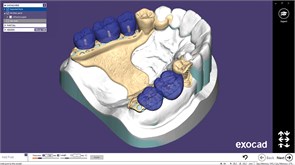 Модуль Exocad Partial Framework 2027439109