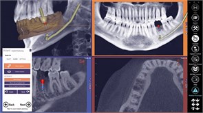 Программное обеспечениеМодуль Exocad DICOM viewer 1147787005